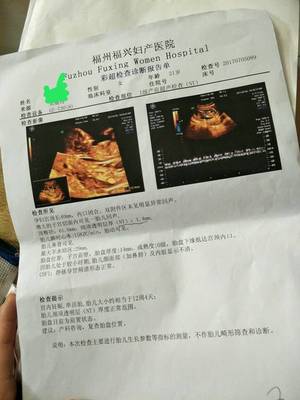 宝妈们好