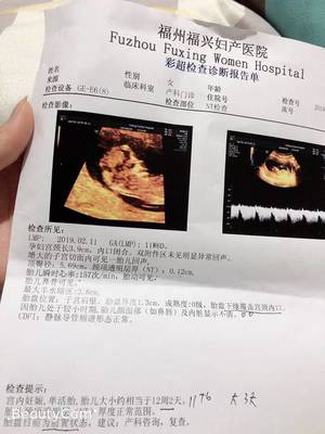 NT顺利通过