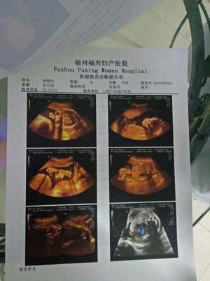 求大家帮忙看下男女,6个月半了