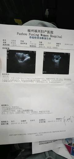 6+2的B超报告
