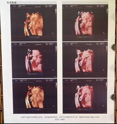 在失望中寻求安慰 我从福州福兴妇产医院产检哭泣后的心路历程